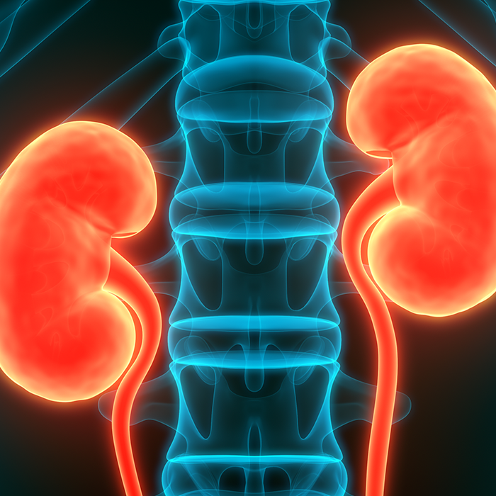 New Value Based Care Agreement Aimed at Improving Outcomes for People with Late-Stage Kidney Disease