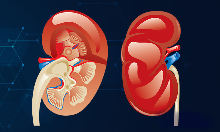 New Study Strongly Links COVID-19 to Acute Kidney Injury (AKI)