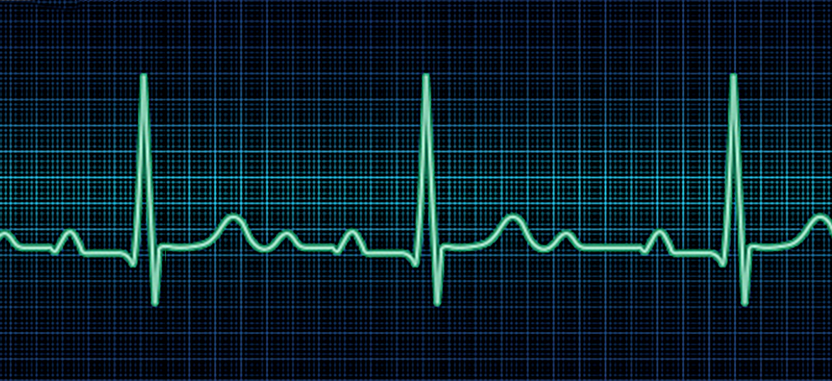 EKG Heart Monitor. PDF file is included.